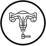 Diagnostic Hysterolaparoscopy, Best Fertility Clinics in Surat