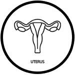 ivf and iui specialist in surat, Ovarian Cyst Removal